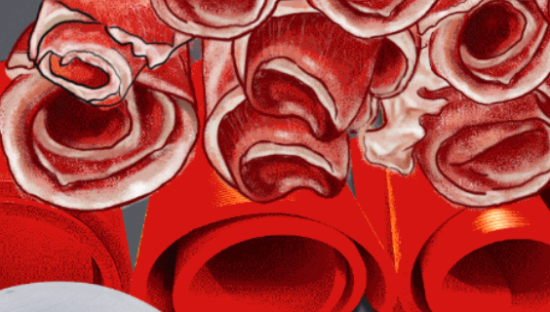 人家健身房里想锻炼，我想段子