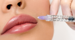 爱美客IPO的“钱景”隐患